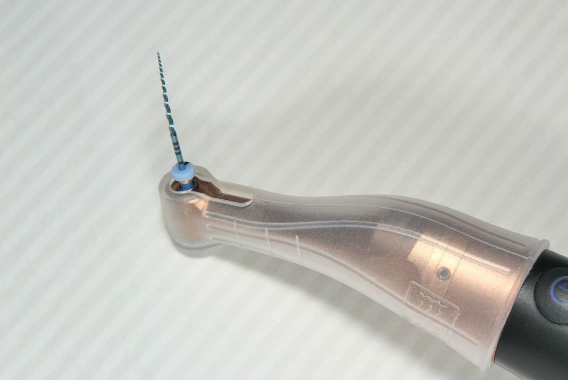 根管治療イメージ図